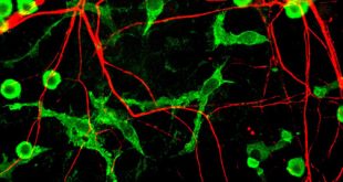 La relación entre dormir bien, la limpieza del cerebro y las enfermedades neurodegenerativas