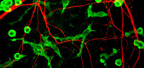 La relación entre dormir bien, la limpieza del cerebro y las enfermedades neurodegenerativas